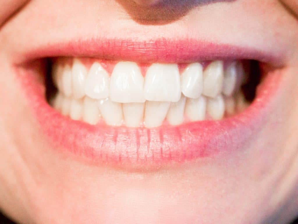 Eight Common Bite Issues That Are Corrected With Orthodontic Treatment