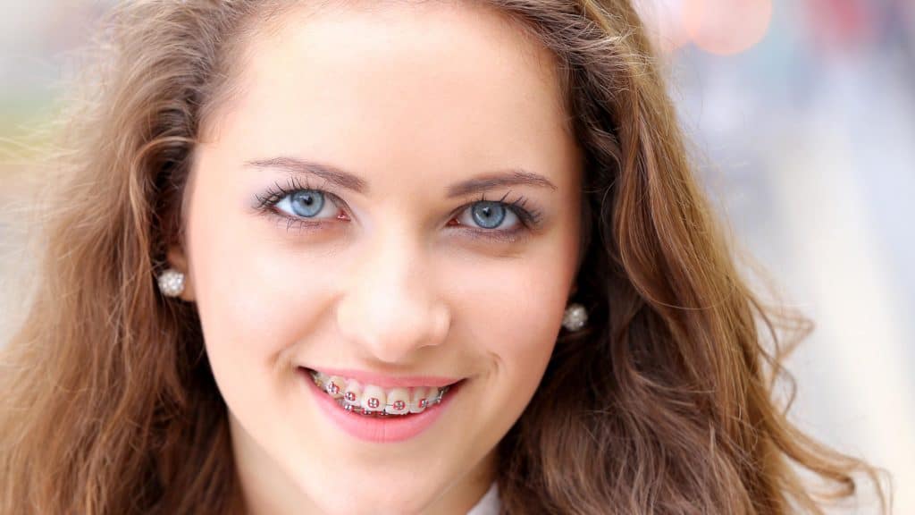 Which orthodontic braces are right for you