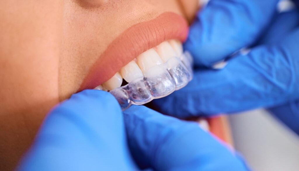 Invisalign being fitted on teeth at orthodontist in Mansfield, TX