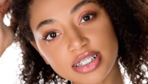 Woman with braces experiencing discomfort at Mansfield orthodontist